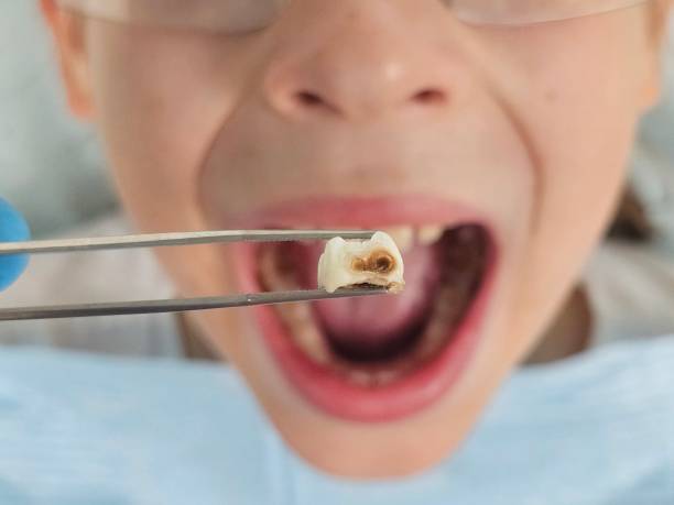 Best Pediatric Emergency Dentist in Wenonah, NJ